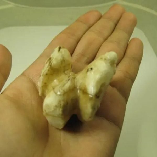 White God Monkey Pearl - Type C3 - Image 3