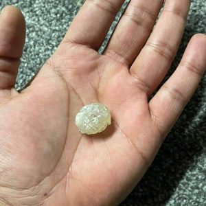Tiger Forehead Pearls - Type A